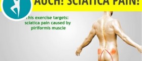 Piriformis syndrome: sciatic pain relief stretches and exercises
