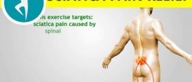 Rehabilitation exercise for people suffering from spinal stenosis sciatica pain