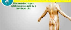 Sciatica exercises: herniated disc rehabilitation